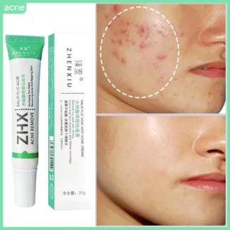 Creme Facial Anti Acne Acido Salicilico Clareador de Cicatrizes